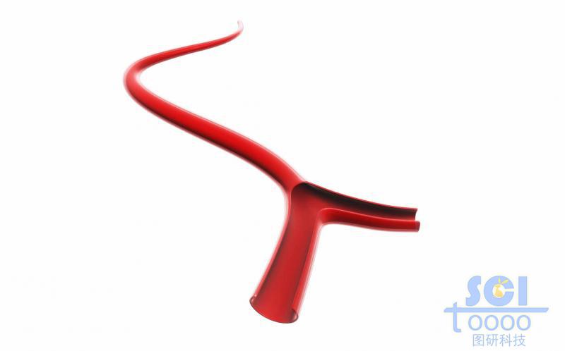 前段帶分支帶切口的血管