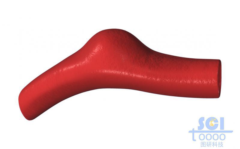 帶腫瘤結(jié)構(gòu)的血管