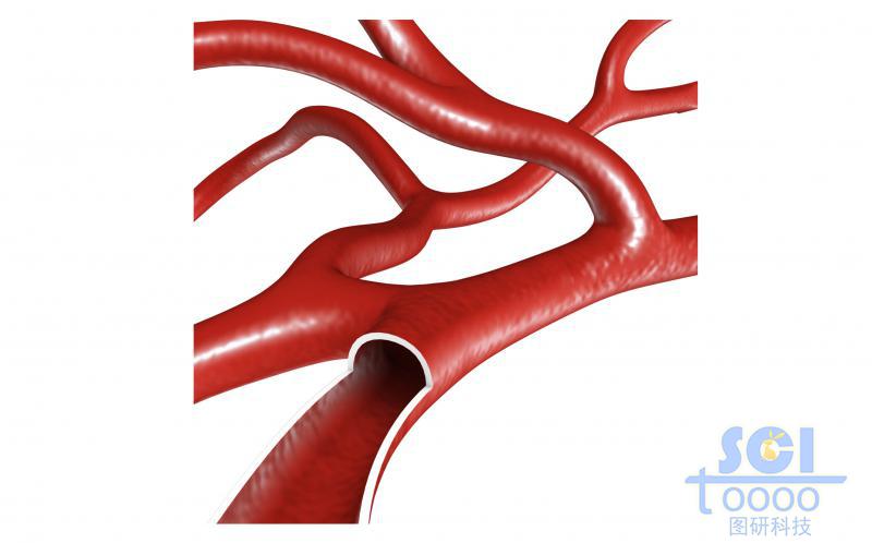 帶切口帶毛細(xì)血管分支的血管結(jié)構(gòu)